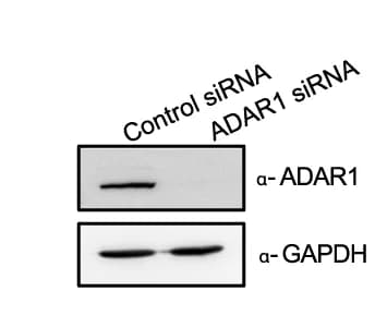 Open access visualization of Gel, Lysates, ADAR1, siRNA treated cells, BCBL1 Cells