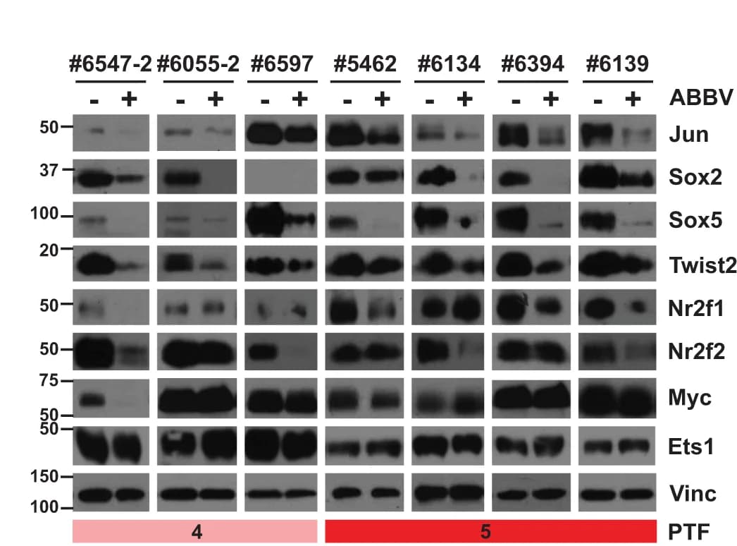 Open access visualization of Gel, Western Blot, Proteins, PDAC Lines, ABBV