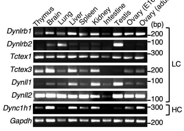 Open access visualization of Gel, Tissue-Specific Expression, Mouse Genes, Reverse Transcription PCR, Embryonic Day
