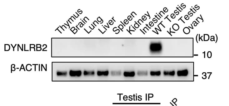 Open access visualization of Gel, Tissue-Specific Expression, DYNLRB2, beta-ACTIN, Western Blotting