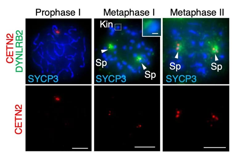 Open access visualization of Microscopy, Immunostaining, Wild-Type Spermatocytes, Spindle Pole, Kinetochore