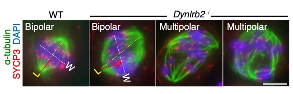 Open access visualization of Microscopy, Immunostaining, Metaphase I Spermatocytes, Spindle Poles, Metaphase Plate