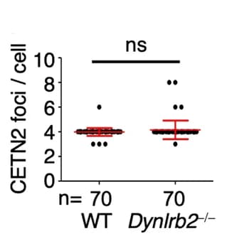 Open access visualization of Box Plot, CETN2 Foci, Quantification, Metaphase I