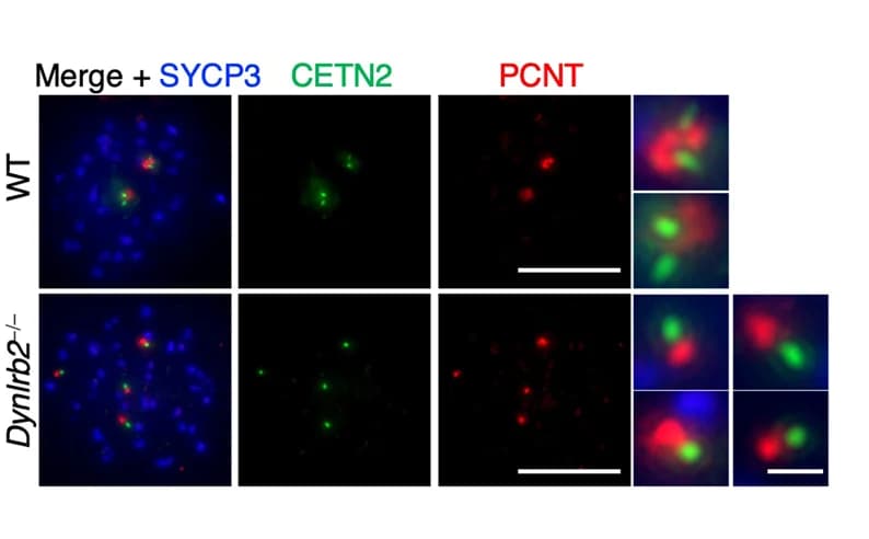 Open access visualization of Microscopy, Immunostaining, Metaphase I Spermatocytes, Scale Bar, Magnified Panel