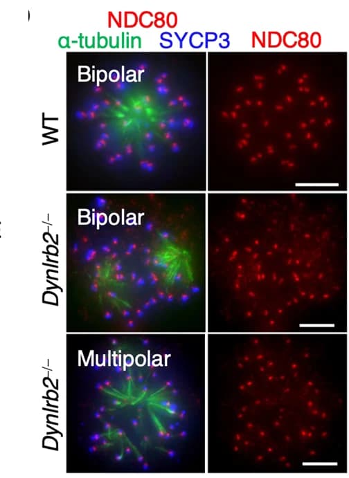Open access visualization of Microscopy, Immunostaining, Metaphase I Spermatocytes, Antibodies, Spindle Poles