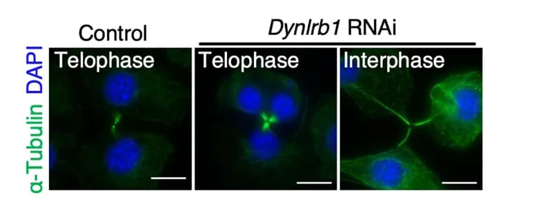 Open access visualization of Microscopy, B16-F1 Cells, Immunostaining