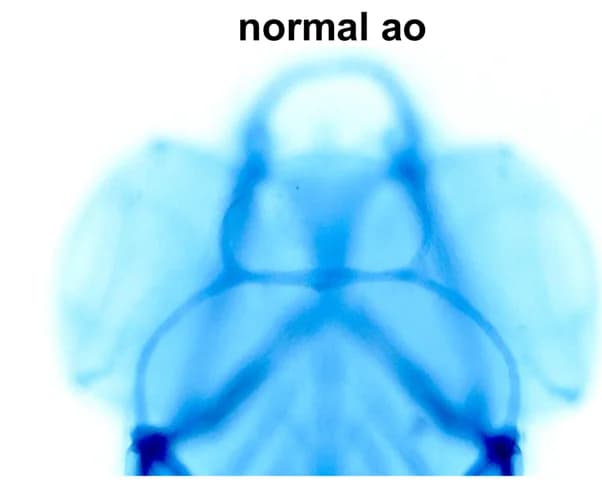 Open access visualization of Microscopy, Photo, Anterior Orbital, Embryos, MTX