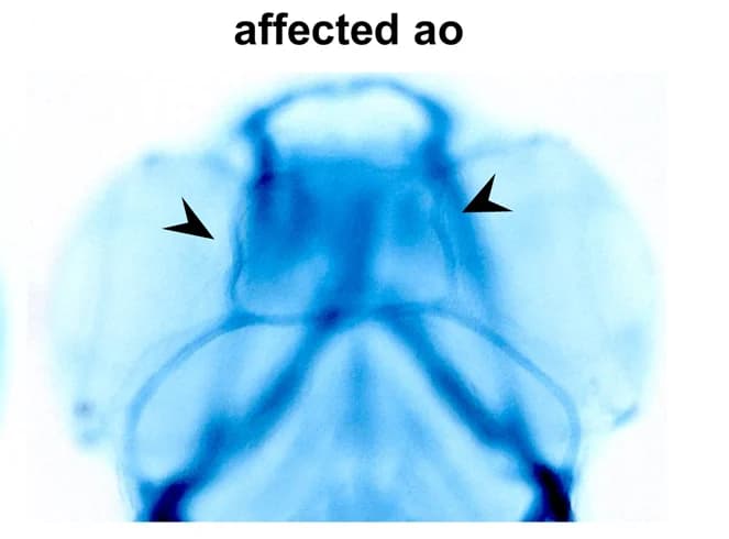 Open access visualization of Microscopy, Anterior Orbital, Embryos, MTX