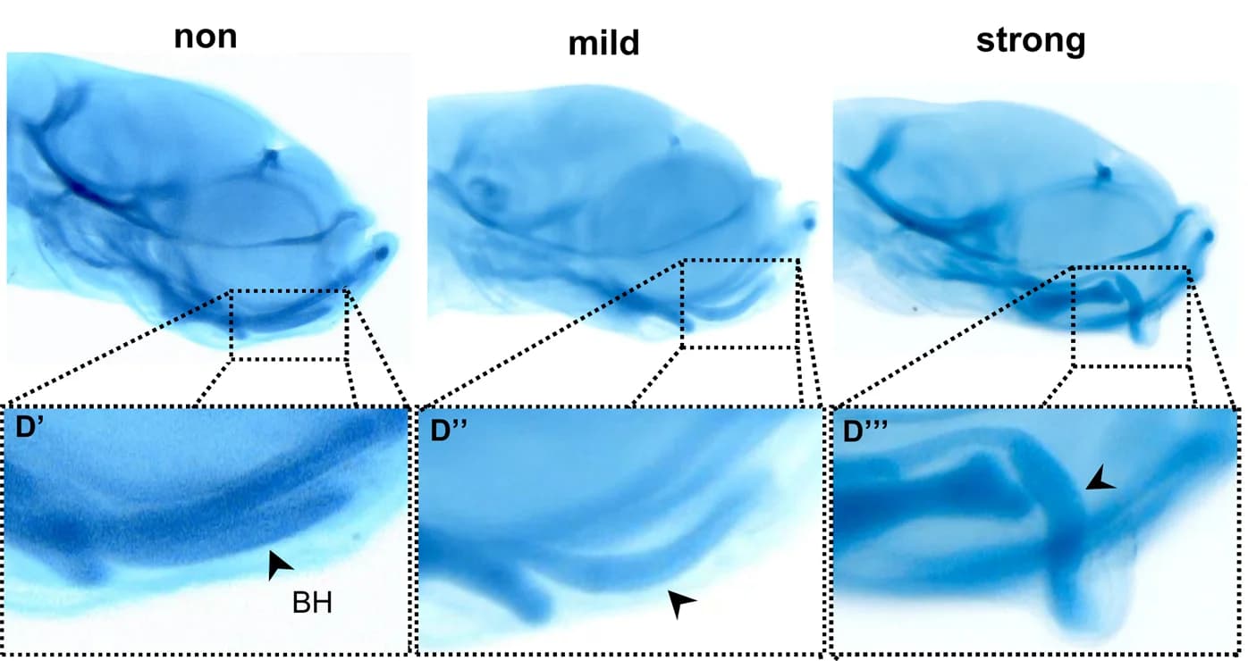 Open access visualization of Microscopy, Photo, Larvae, Basihyal Cartilage, Deformities