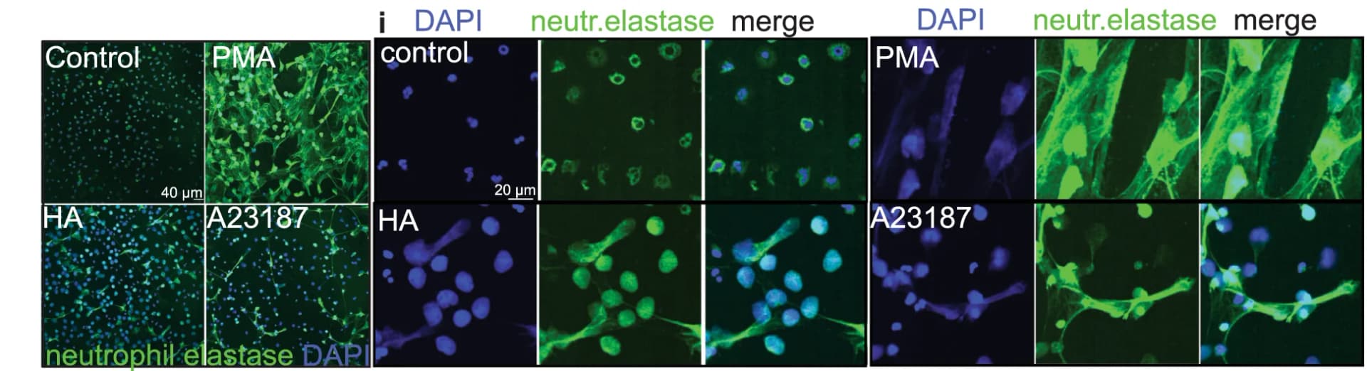 Open access visualization of Microscopy, Neutrophil Elastase Staining, HA, PMA, A23187