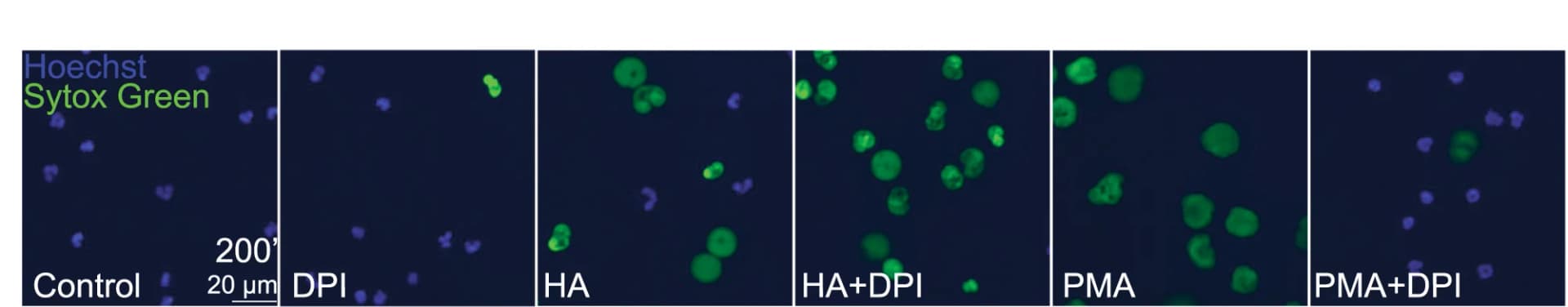 Open access visualization of Microscopy, NET Formation, Time-Lapse Microscopy, NOX Inhibition