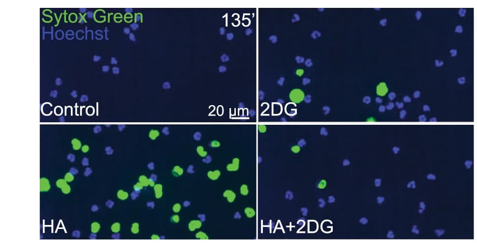 Open access visualization of Microscopy, 2DG treatment, HA-induced NET formation, Time-lapse microscopy