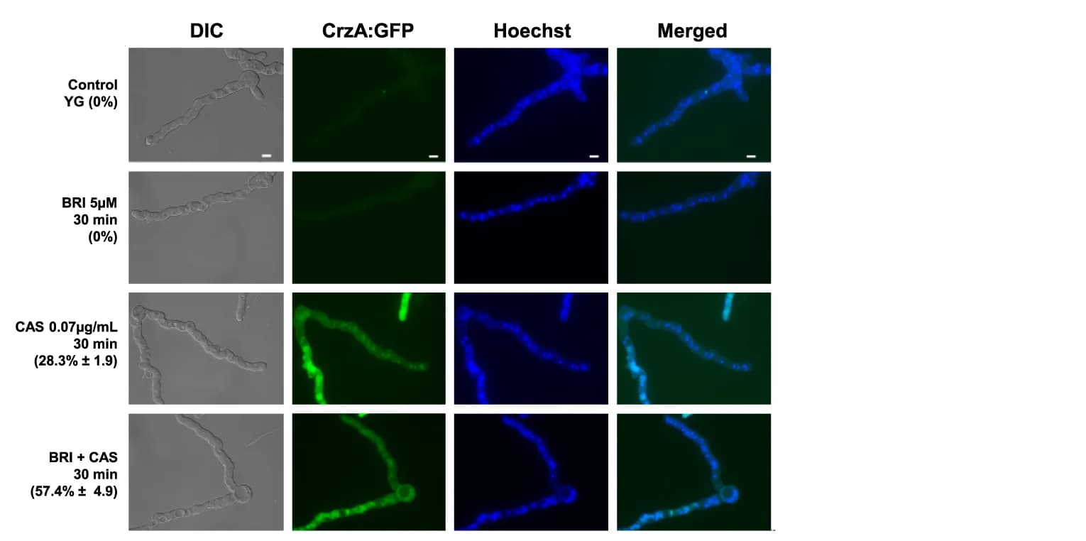 Open access visualization of Microscopy, CrzA:GFP Translocation, Nucleus, Germlings, BRI