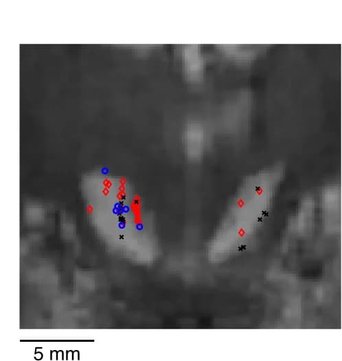 Open access visualization of Microscopy, GABAergic Neurons, DA Neurons, Monkey, Recording Locations