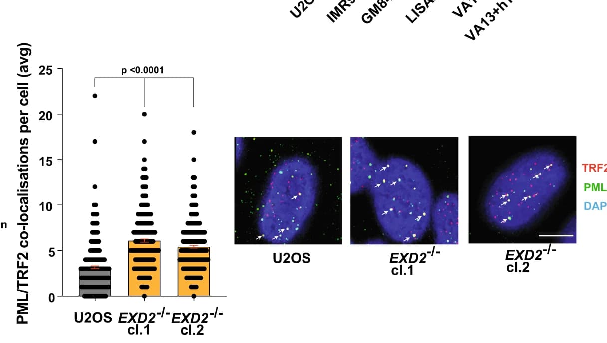 Open access visualization of Bar Plot, Error Bars, Microscopy, ALT-Associated PML Bodies, EXD2 -/- U2OS Cells