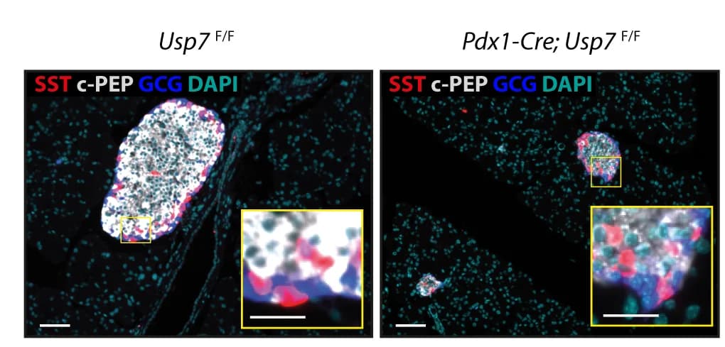Open access visualization of Microscopy, Immunofluorescence, Amylase, CK19, Insulin