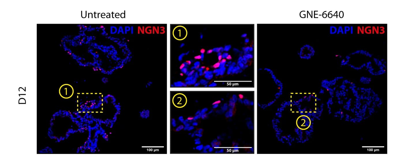 Open access visualization of Microscopy, NGN3, Immunofluorescent Staining, Control Samples, GNE-6640 Treatment