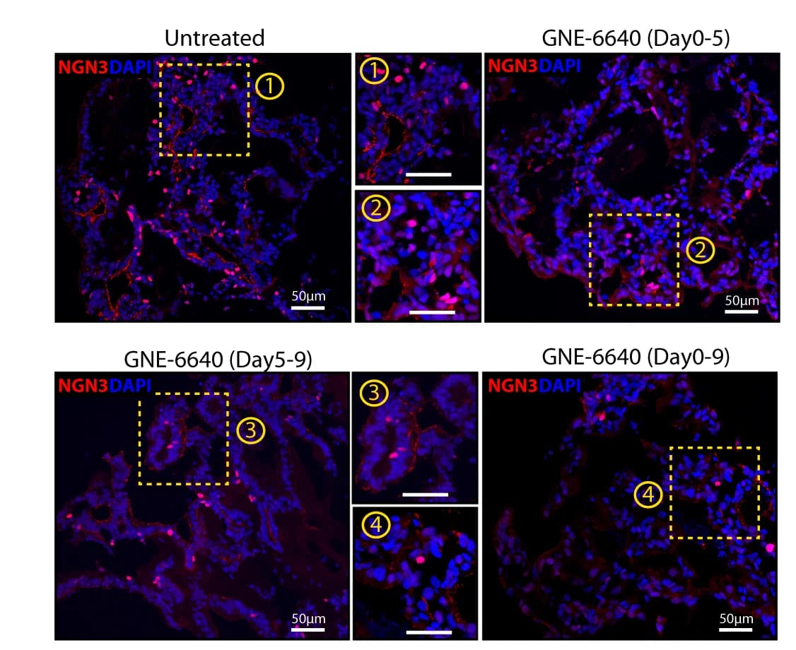 Open access visualization of Microscopy, NGN3, Immunofluorescent Staining, Control Samples, GNE-6640-Treated Samples