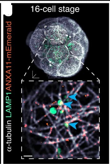 Open access visualization of Microscopy, LAMP1, Vesicular structures, Microtubule filaments