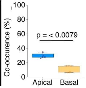 Open access visualization of Box Plot, Ribosomes, Puromycin, Apical Region, Basal Region