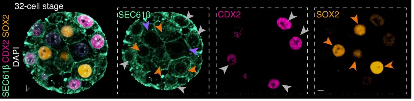 Open access visualization of Microscopy, Immunofluorescence, Blastomeres, Trophectoderm, CDX2