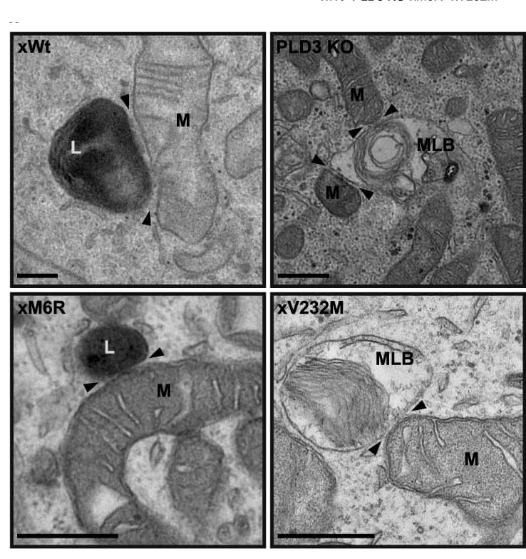 Open access visualization of Microscopy, Electron microscopy images, Mitochondria, Lysosomes, Multilamellar bodies