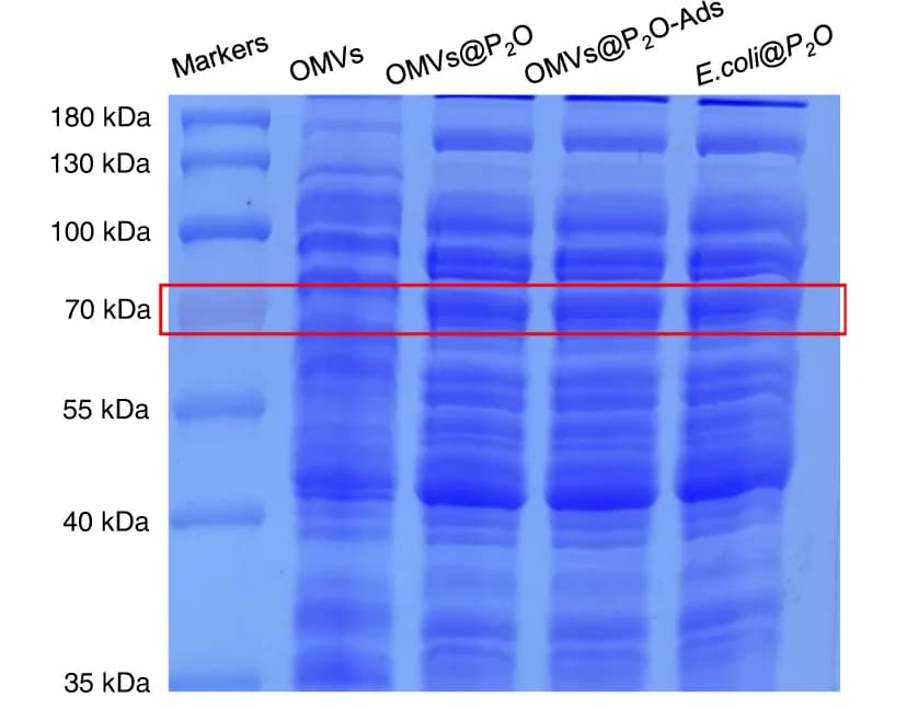 Open access visualization of Gel, Expression, P2O, SDS-PAGE