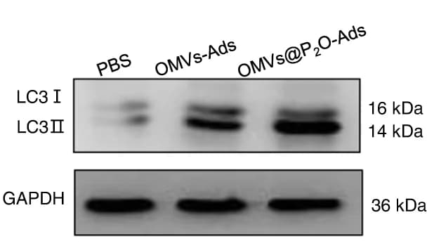 Open access visualization of Gel, Expression, Autophagy-Related Protein, LC3-I, LC3-II