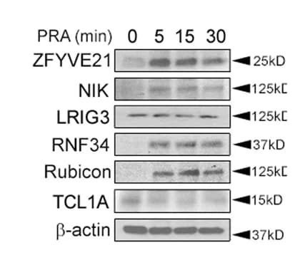 Open access visualization of Gel, HUVECs, Western Blotting, Rab5 Pulldowns, Proximity Ligation Assays
