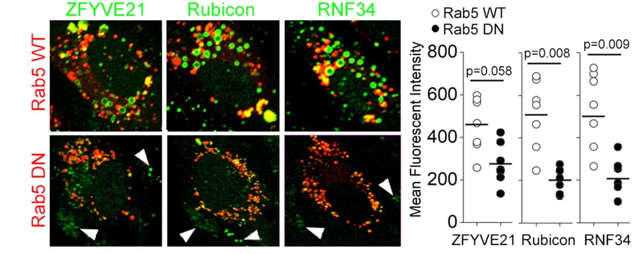 Open access visualization of Microscopy, Scatter Plot, HUVECs, Rab5 WT, Rab5 DN