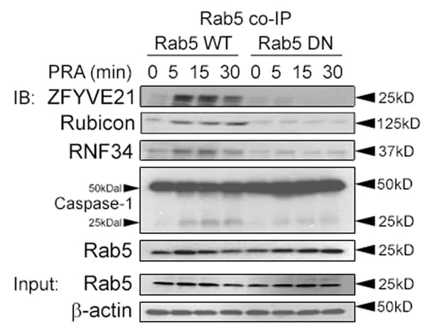 Open access visualization of Gel, HUVECs, Rab5 WT, Rab5 DN, PRA