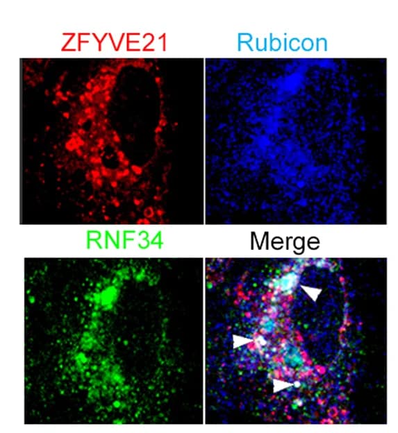 Open access visualization of Microscopy, HUVECs, ZFYVE21-RFP, Rubicon-BNP, RNF34-GFP