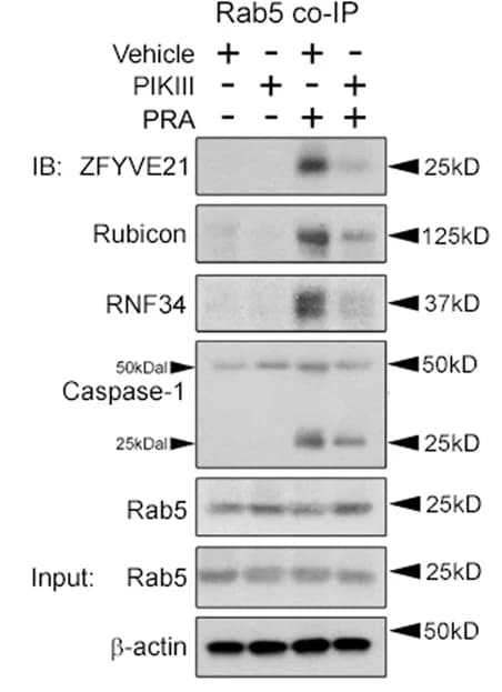 Open access visualization of Gel, HUVECs, ZFYVE21 siRNA, PIKIII, PRA
