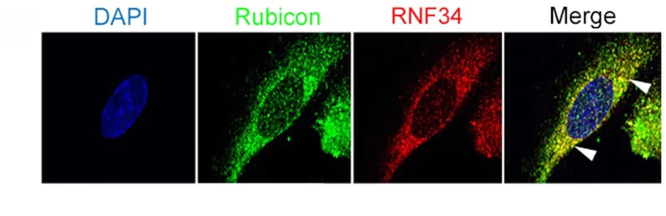Open access visualization of Microscopy, HUVECs, Rubicon-GFP, RNF34-RFP, Confocal Microscopy