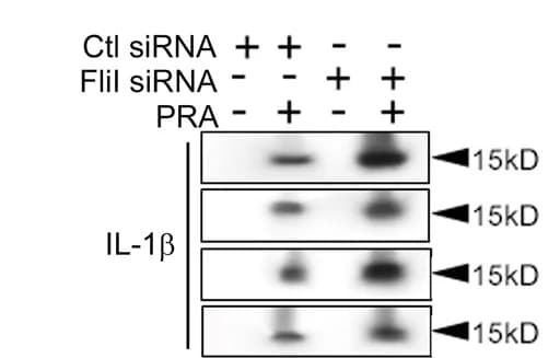 Open access visualization of Gel, HUVECs, FliI siRNA, Culture Supernatants
