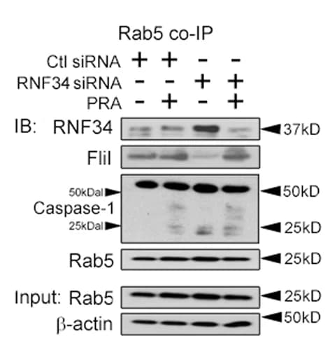 Open access visualization of Gel, HUVECs, siRNA, Rab5, Co-IPs