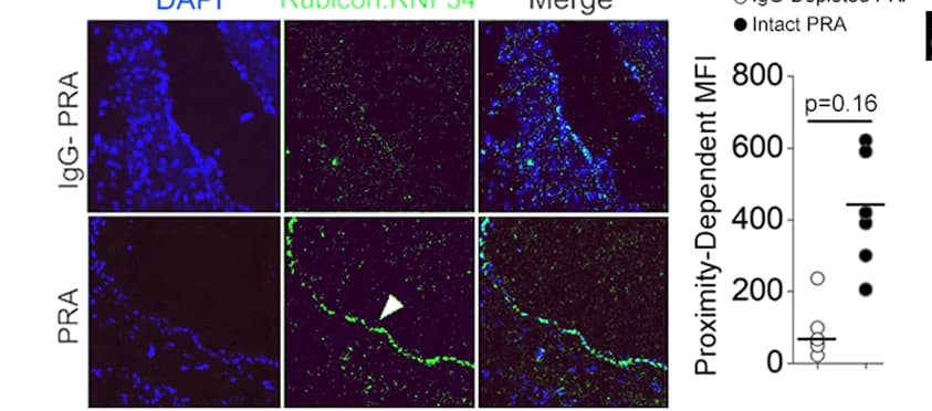Open access visualization of Microscopy, Scatter Plot, Human Artery Xenografts, SCID/beige Hosts, Proximity Ligation Assays