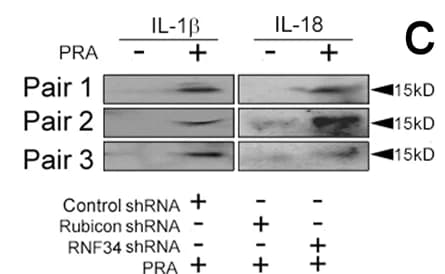 Open access visualization of Gel, SCID/beige Hosts, Human Artery Xenografts, Western Blot