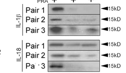 Open access visualization of Gel, SCID/beige Hosts, Collagen Gel Matrices, Western Blot