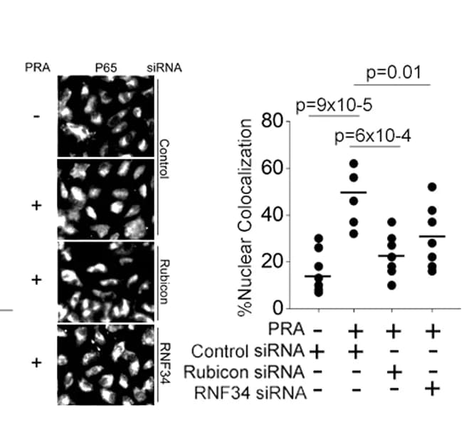 Open access visualization of Scatter Plot, Epifluorescence analysis, Nuclear translocation, P65 NF-κB subunit, HUVECs