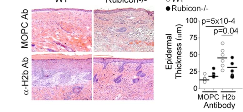 Open access visualization of Microscopy, Scatter Plot, Skin grafts, MOPC, Anti-H-2 b Ab