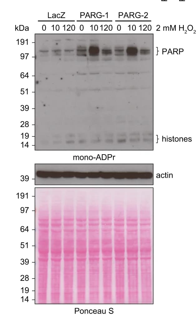 Open access visualization of Gel, Whole-Cell Lysates, SDS-PAGE, Immunoblot, Pan-ADPr