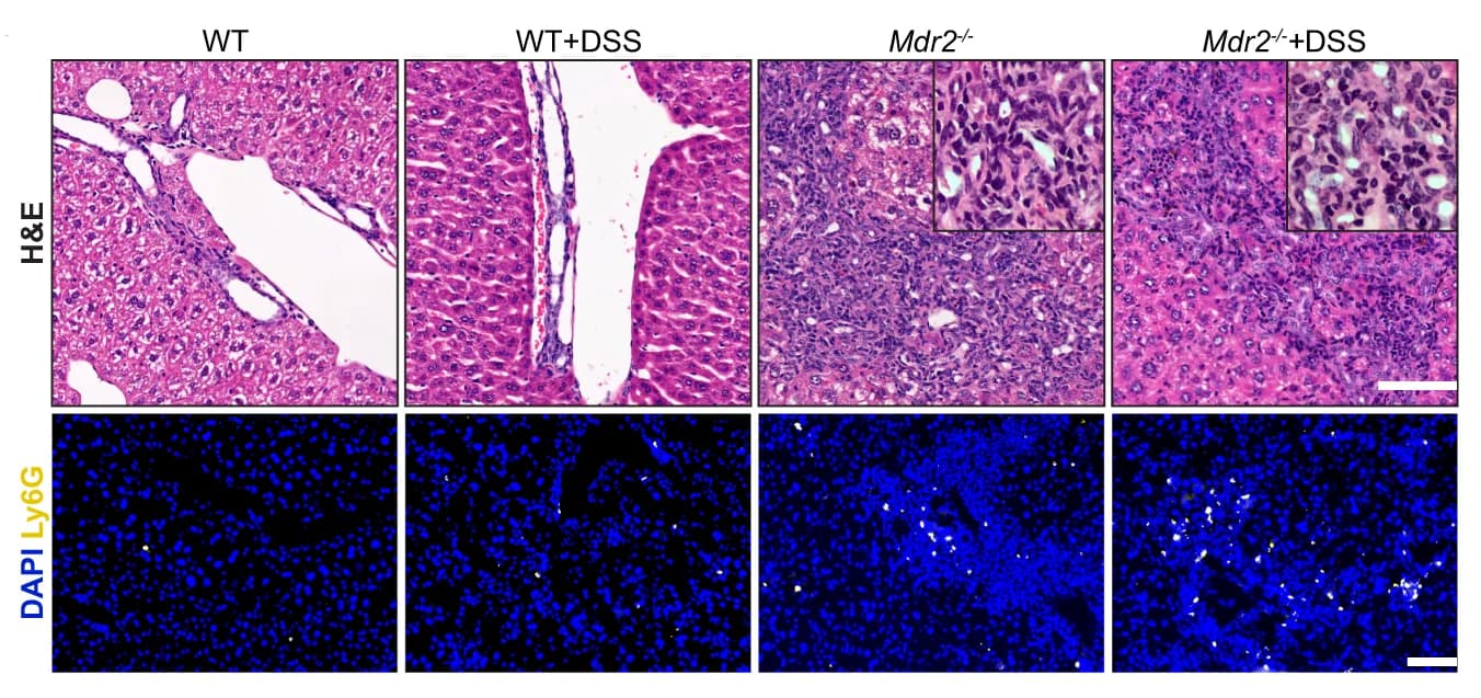 Open access visualization of Microscopy, H&E Staining, Ly6G Staining, Liver Sections