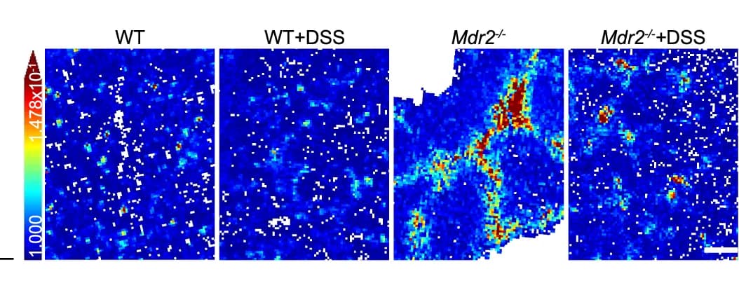 Open access visualization of Heatmap, Spatial Distribution, Taurocholic Acid, Liver, MALDI Mass Spectrometry Imaging