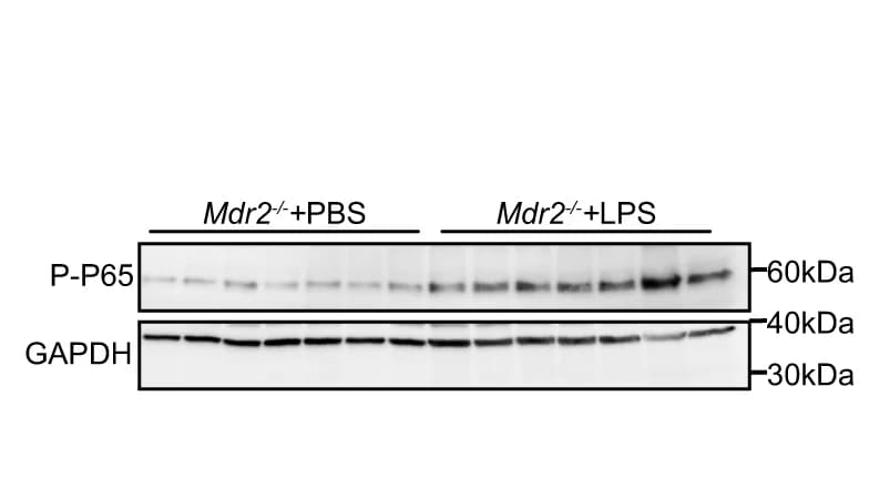 Open access visualization of Gel, Western Blot, Liver, Phosphorylated NF-κB P65