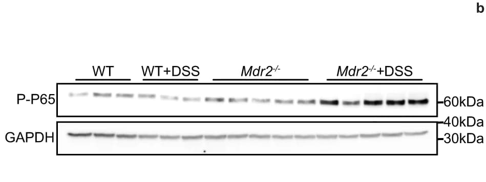 Open access visualization of Gel, Western blot, Liver, Phosphorylated NF-κB P65, WT