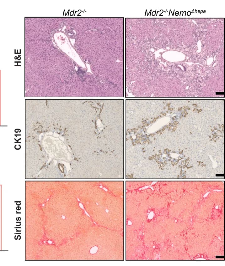 Open access visualization of Microscopy, Representative images, Liver, H&E staining, CK19 staining