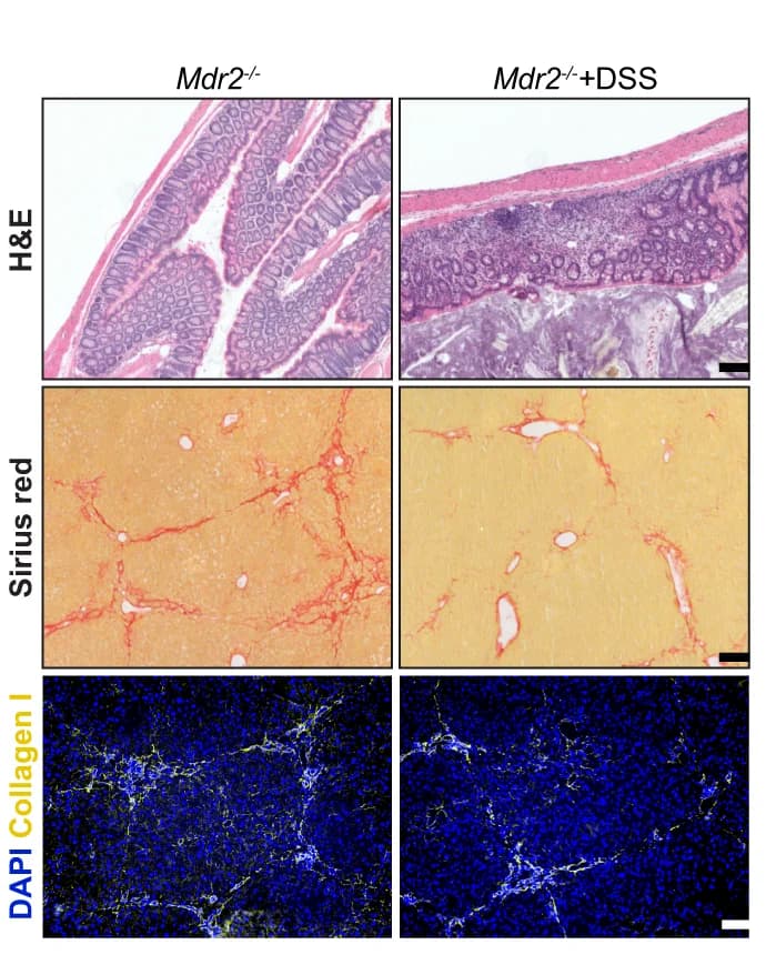Open access visualization of Microscopy, H&E staining, Distal colon, Sirius red, Liver