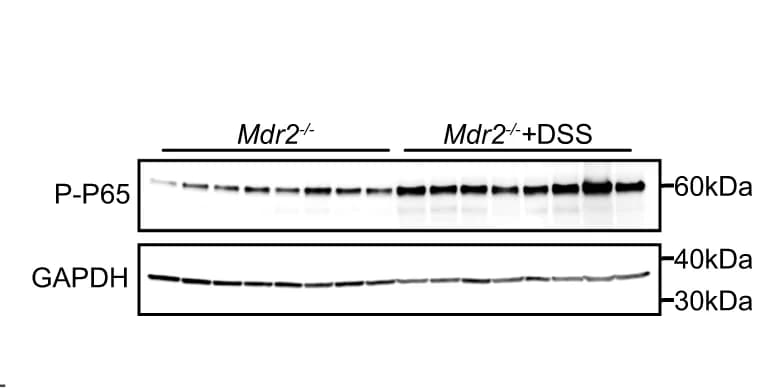 Open access visualization of Gel, Western blot, Liver, Phosphorylated NF-κB P65, Mdr2 knockout mice