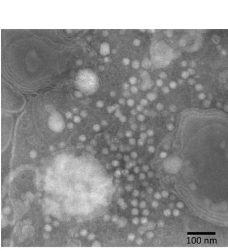 Open access visualization of Microscopy, Virus Particles, Fat Bodies, House Crickets, Electron Microscopy